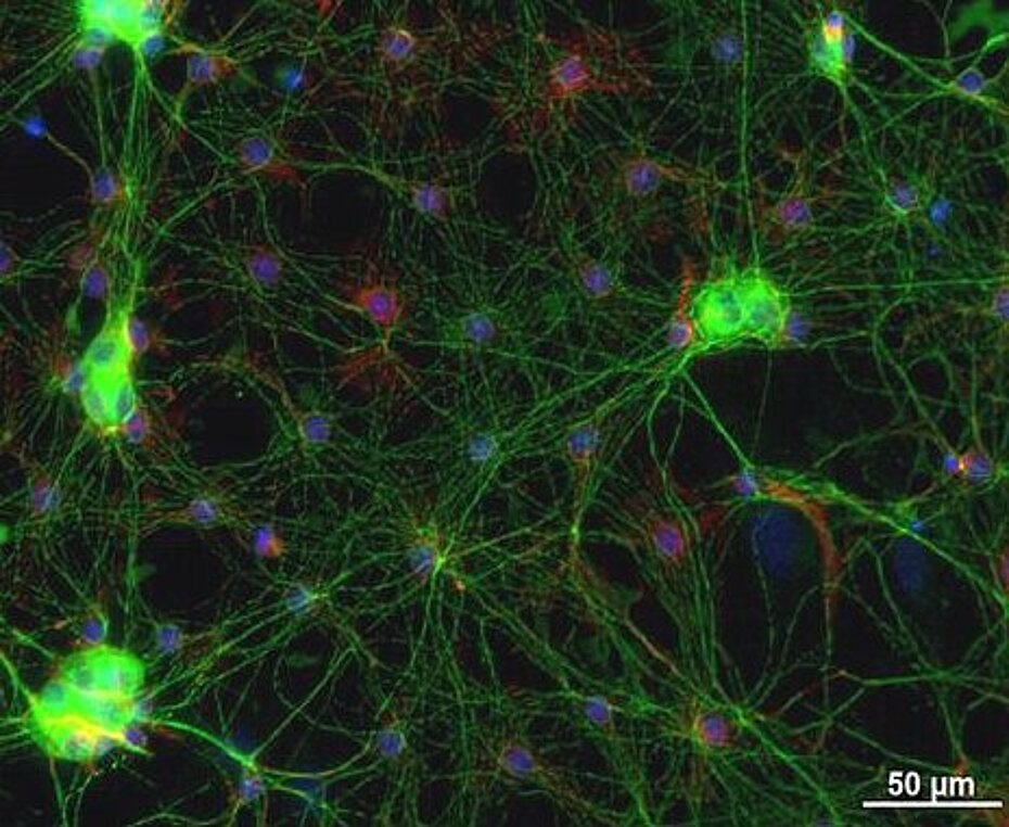Neuronal networks from the gut HSKL