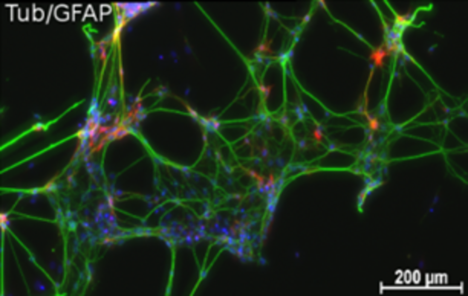 The cell nuclei were stained blue. Top, wild type. Bottom, 5XFAD mice. Please notice the enhanced reticulation and neurite gauge in the bottom picture (bachelor thesis S. Ull-Sopha). The cell nuclei were stained blue. Top, wild type. Bottom, 5XFAD mice. Please notice the enhanced reticulation and neurite gauge in the bottom picture (bachelor thesis S. Ull-Sopha).