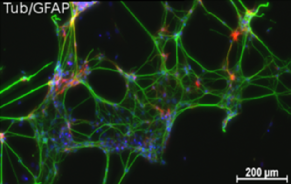 The cell nuclei were stained blue. Top, wild type. Bottom, 5XFAD mice. Please notice the enhanced reticulation and neurite gauge in the bottom picture (bachelor thesis S. Ull-Sopha).