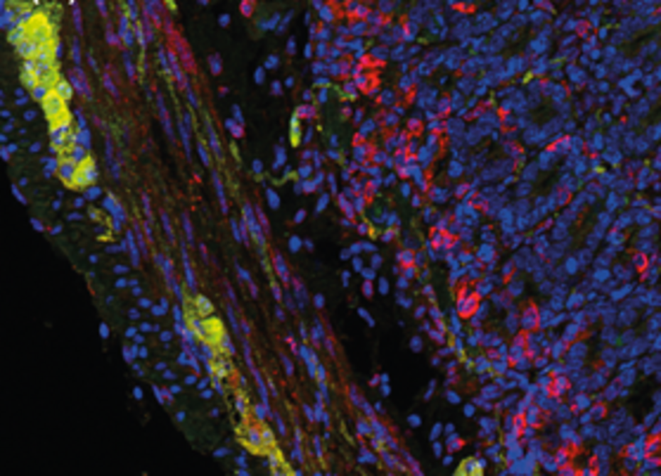 Immune (red) and nerve cells (yellow) in the gut wall Immune (red) and nerve cells (yellow) in the gut wall