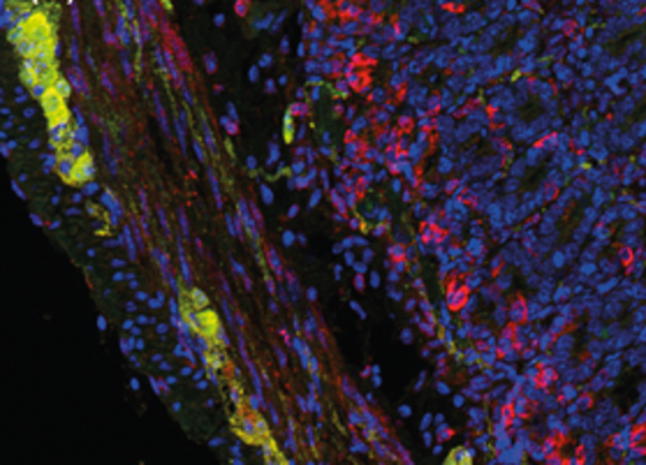 Immune (red) and nerve cells (yellow)  in the gut wall