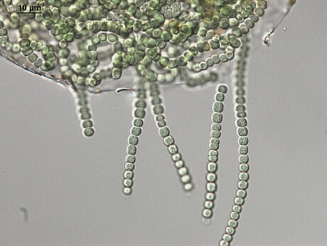 Mikroskopische Aufnahme der Cyanobakterienart Nostoc sp., welches aus der Grit Crust isoliert wurde und nun in der Algensammlung in Pirmasens im Hinblick auf nützliche Stoffwechselprodukte untersucht wird (Foto: Patrick Jung)