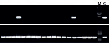 Gel electrophoresis of products from PCR of DNA from 19 difficult samples.Only two samples of DNA purified with established methods (upper row) can be amplified. All DNA samples purified with novel methods can be amplified (lower row). Gel electrophoresis of products from PCR of DNA from 19 difficult samples.Only two samples of DNA purified with established methods (upper row) can be amplified. All DNA samples purified with novel methods can be amplified (lower row).